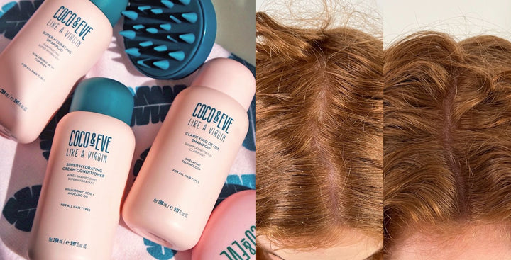How to Fix Dry Scalp: Expert Tips and Remedies